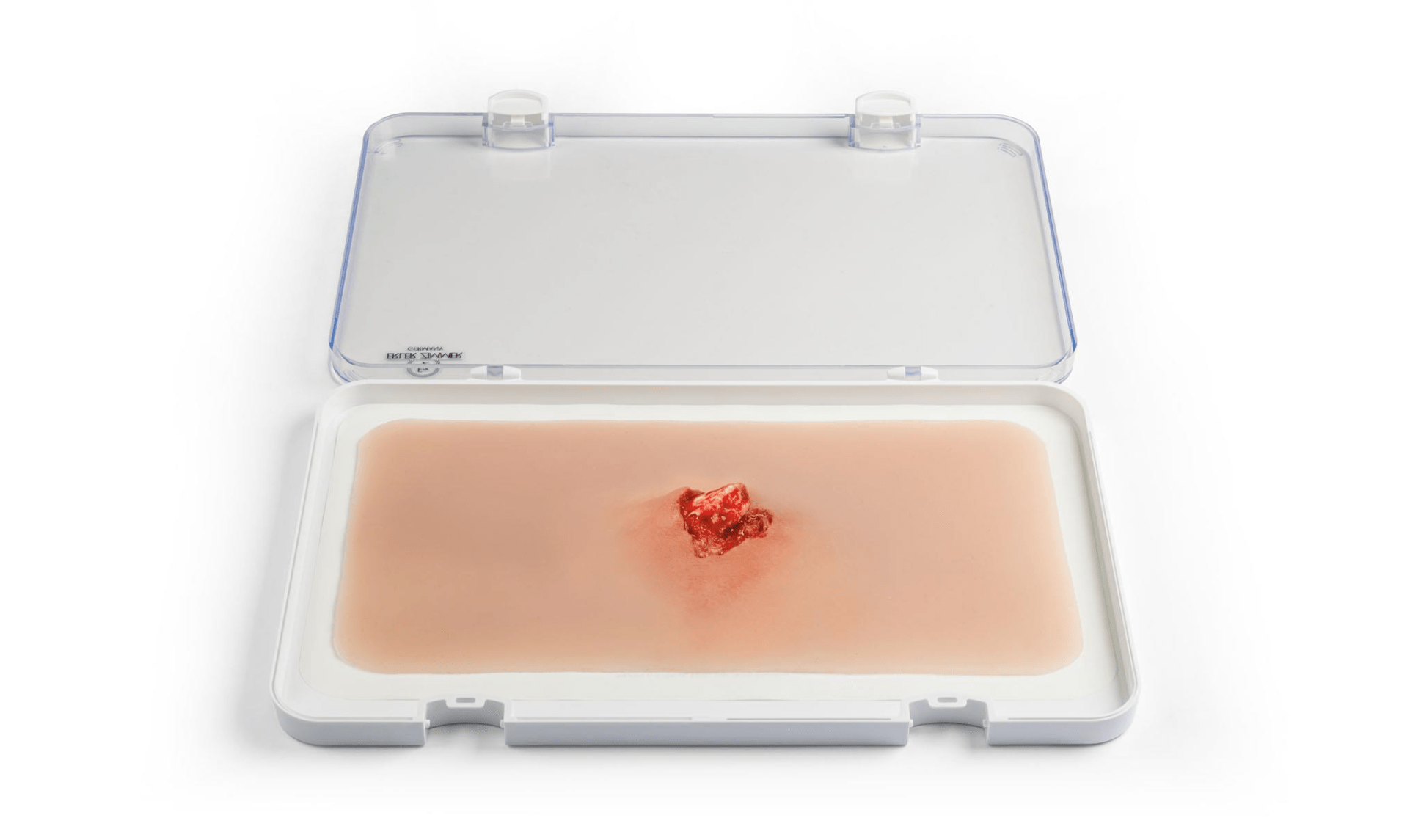 Offener Bruch Arm mit Blutungsfunktion - Erler - Zimmer